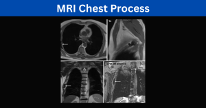 MRI Chest Process and Diagnosis