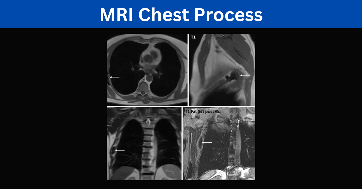 MRI Chest