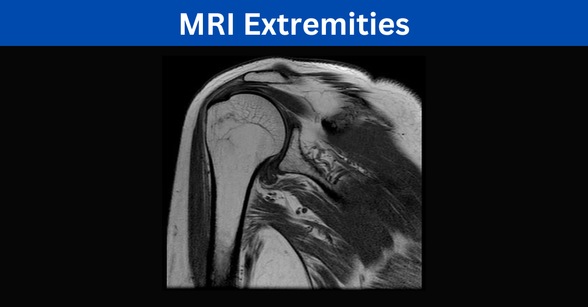 MRI Extremities