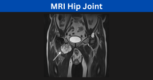 MRI Hip Joint Process and Diagnosis