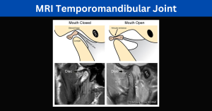 MRI Temporomandibular Joint Process and Diagnosis