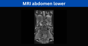 MRI abdomen lower Process and Diagnosis