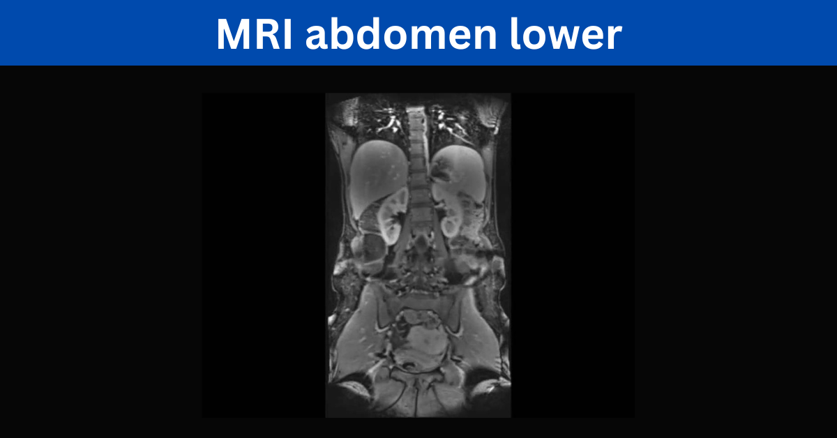 MRI abdomen lower
