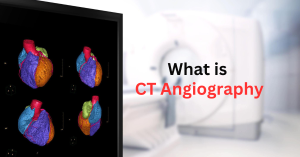 What is CT Angiography | Orbit Diagnostics