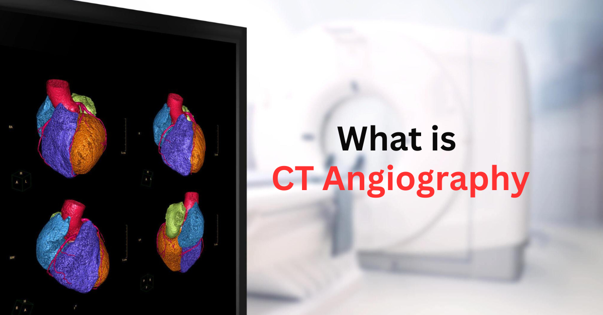 What is CT Angiography