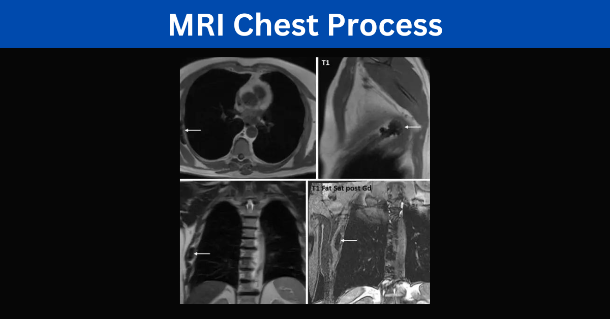 Mri Chest Process And Diagnosis