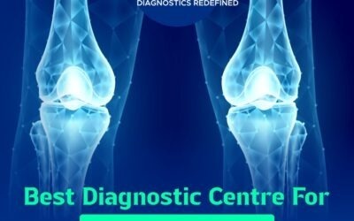 Best Diagnostic Centre for Bone DEXA Scan in Delhi – Orbit Imaging & Pathlab