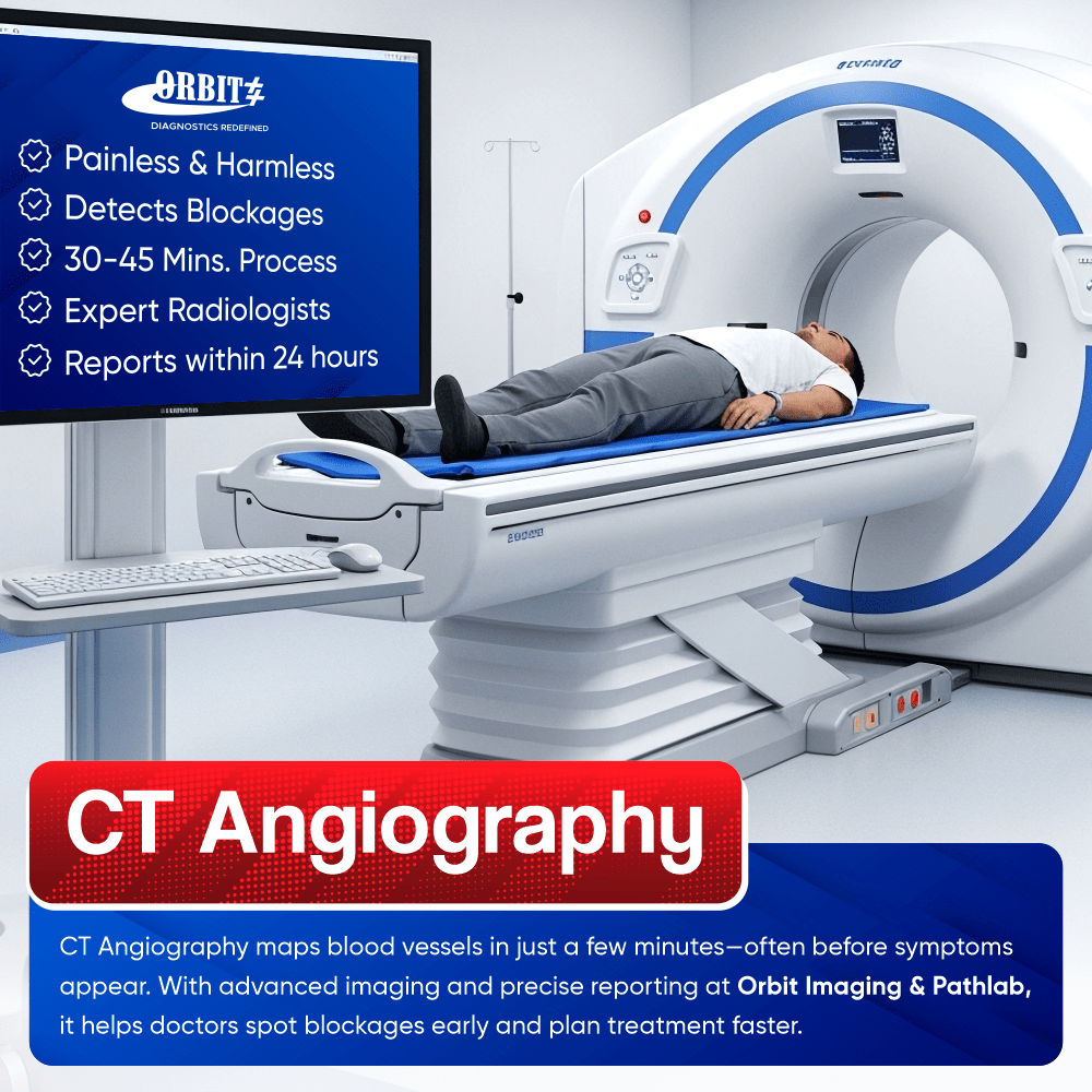 Best CT Angiography in Delhi