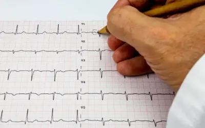 First Test for Heart Problems: ECG Explained