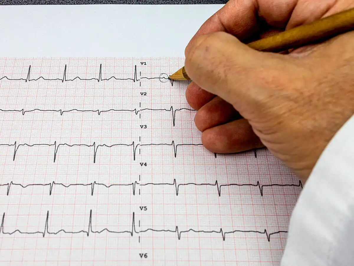 First Test for Heart Problems: ECG Explained