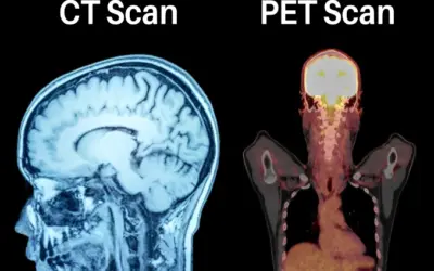 PET-CT vs CT Scan: What’s the Difference & Which One Do You Actually Need?