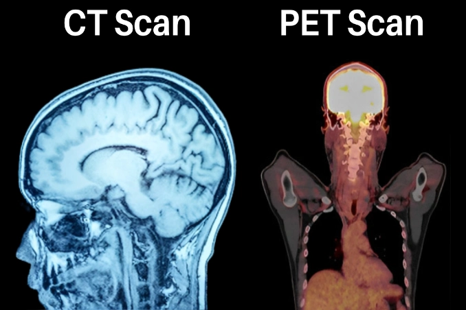 PET-CT vs CT Scan: What’s the Difference & Which One Do You Actually Need?